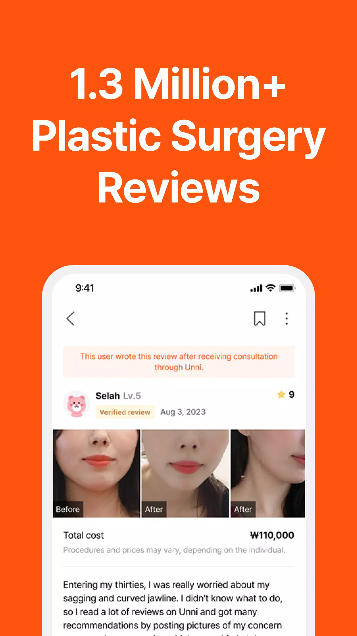 UNNI: Plastic Surgery & Review