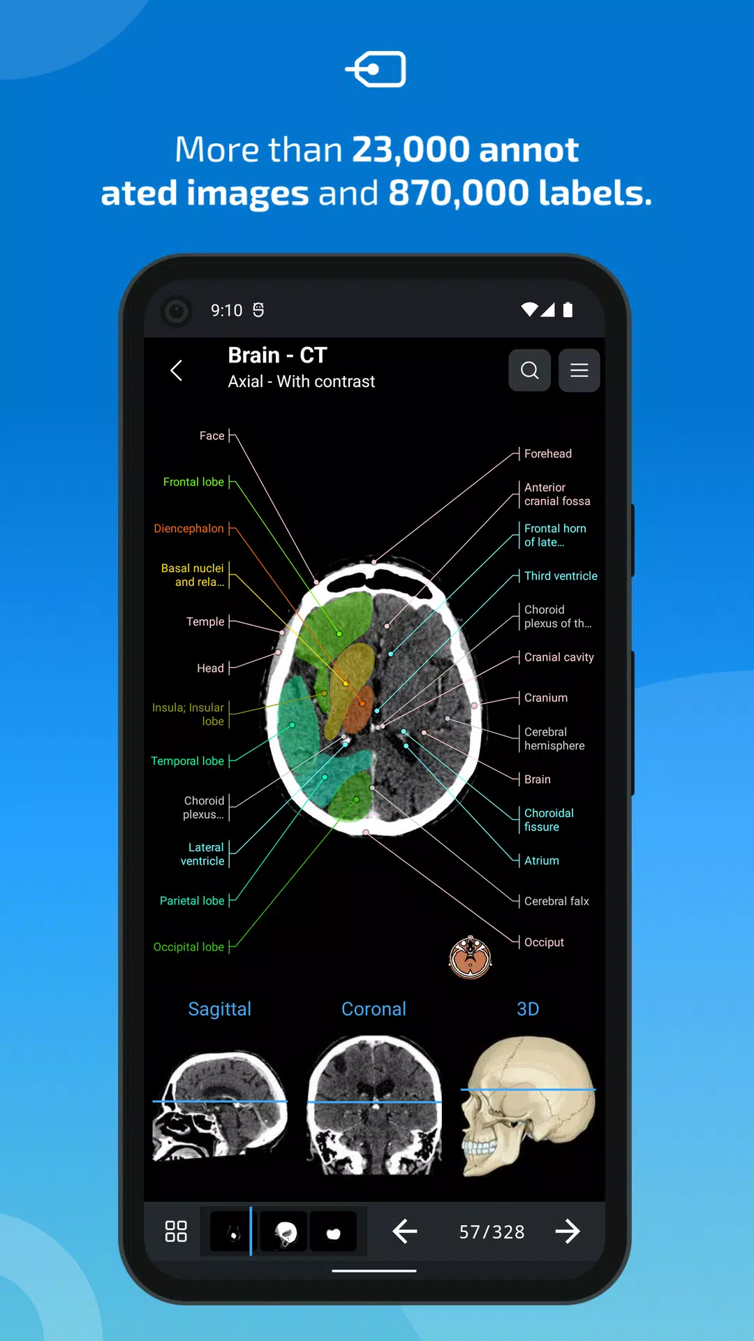 e-Anatomy স্ক্রিনশট 1