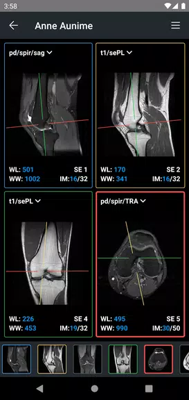 IDV - IMAIOS DICOM Viewer Tangkapan skrin 2