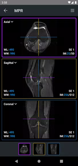 IDV - IMAIOS DICOM Viewer Schermafbeelding 3