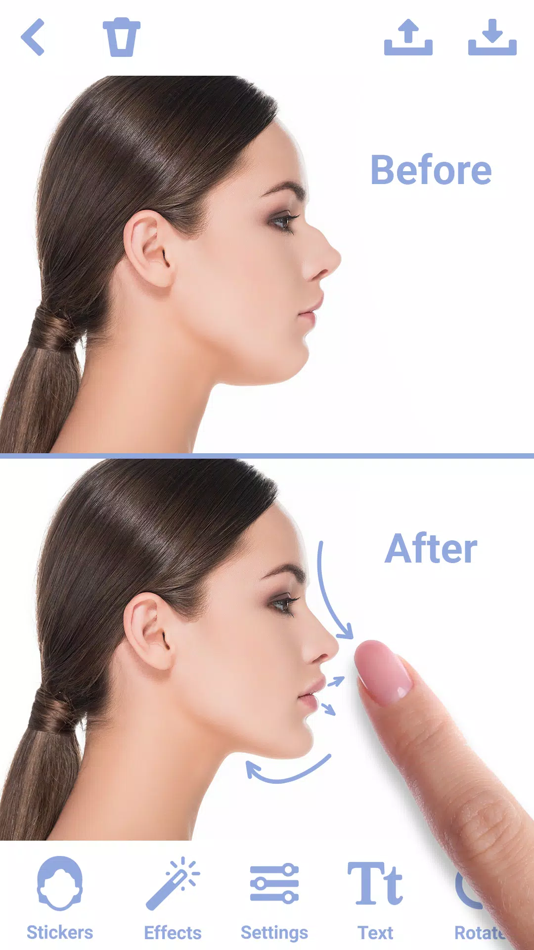 Rhinoplasty Captura de tela 0