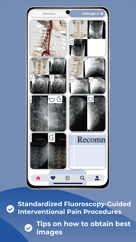 Interventional Pain App應用截圖第2張